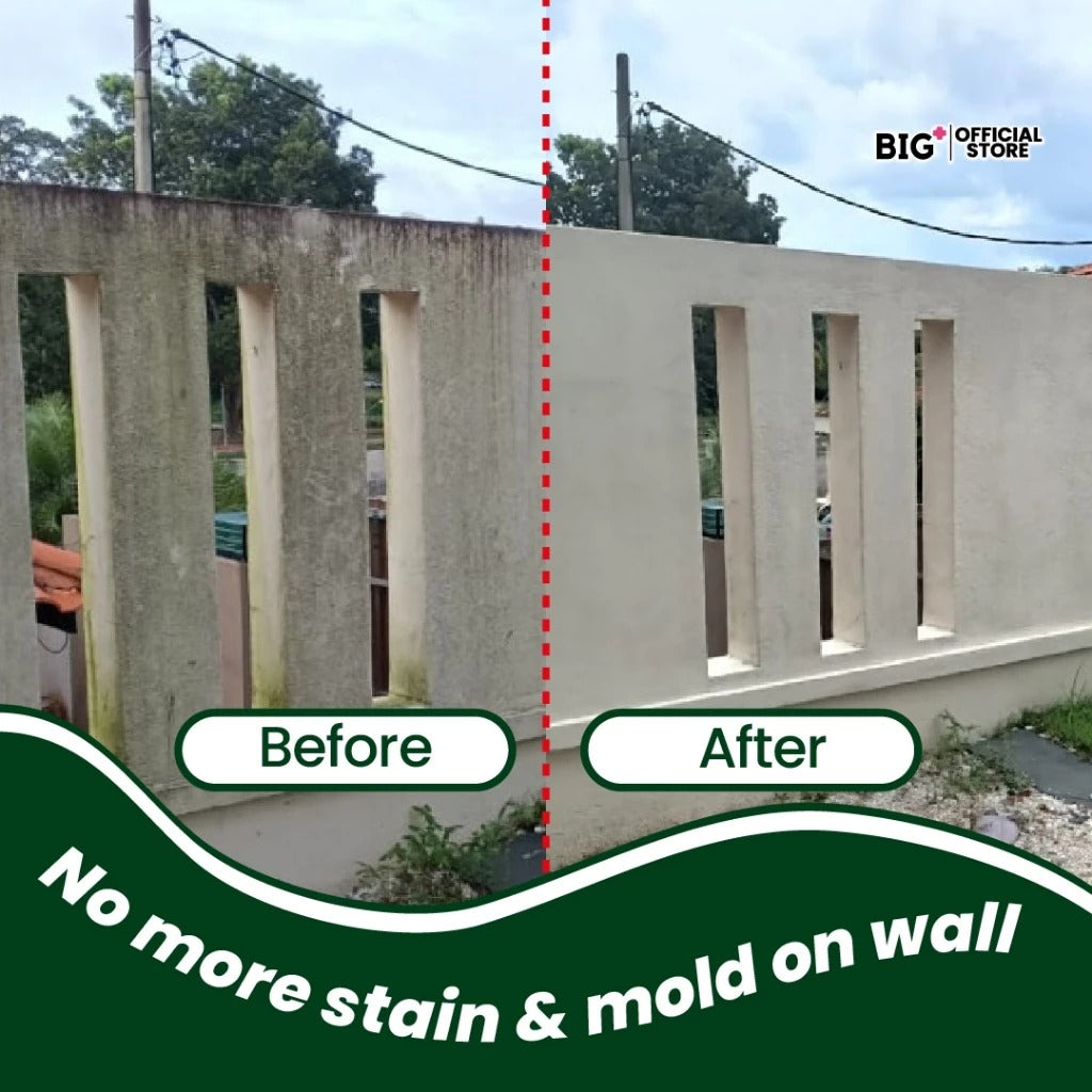 BIG+ Stain Removal Set