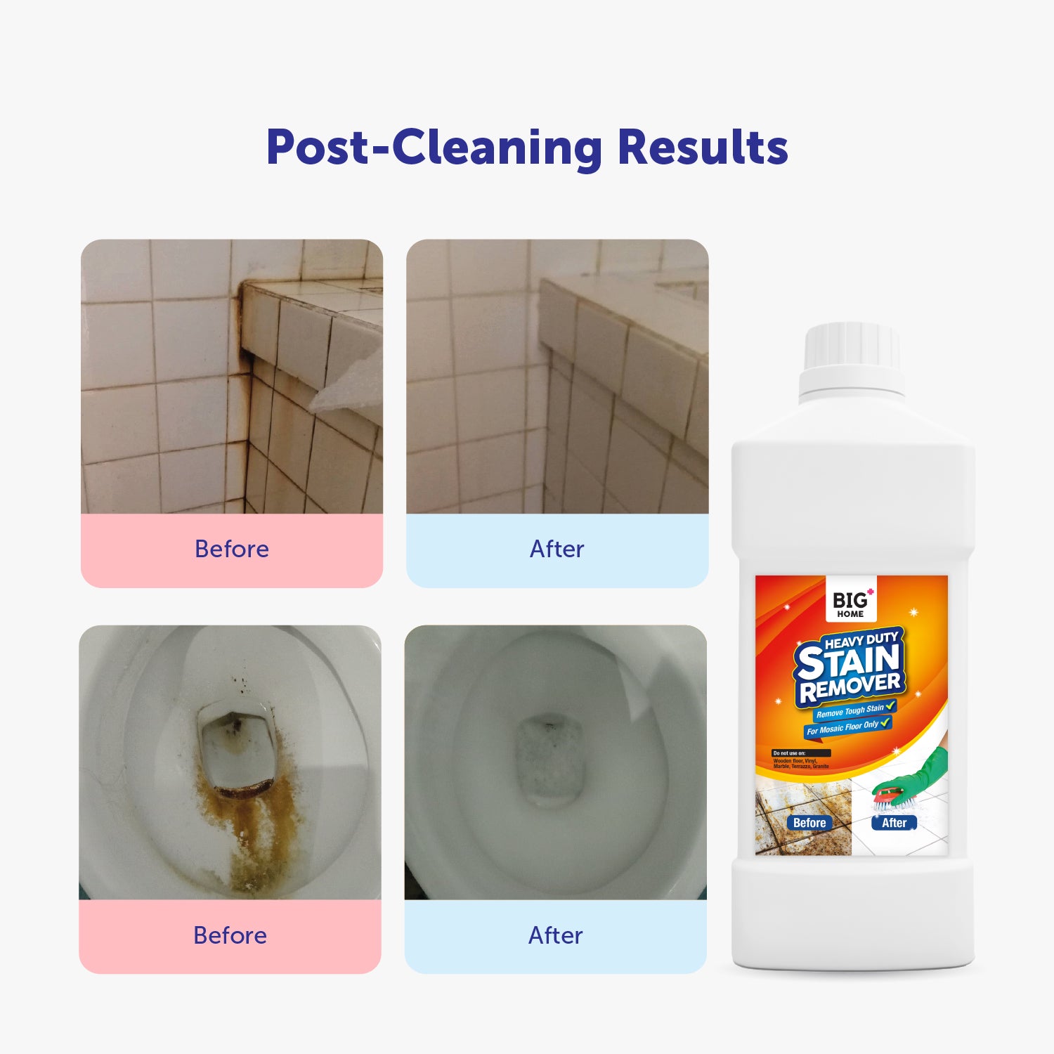 BIG+ HomeCare Complete Set