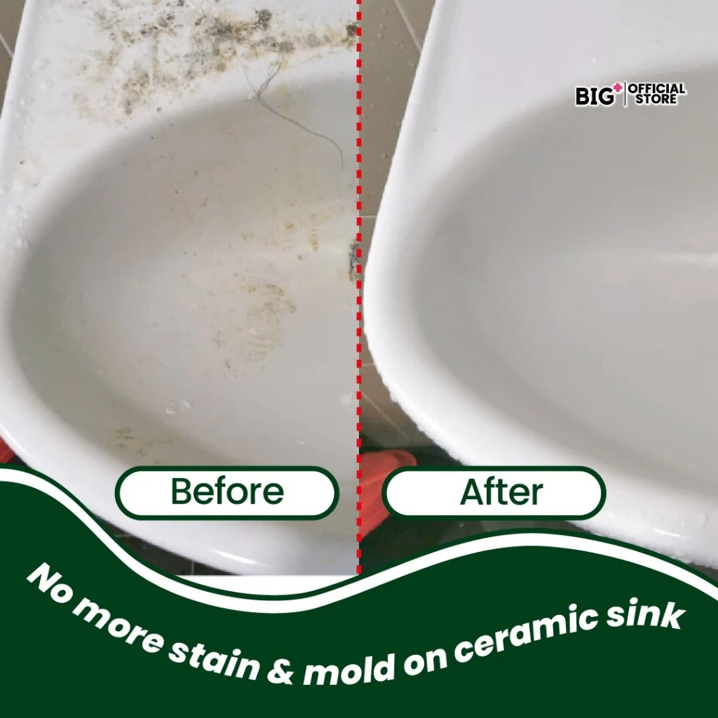 BIG+ Stain Removal Set