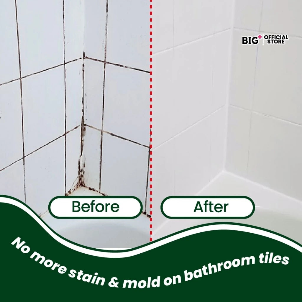 BIG+ Stain Removal Set