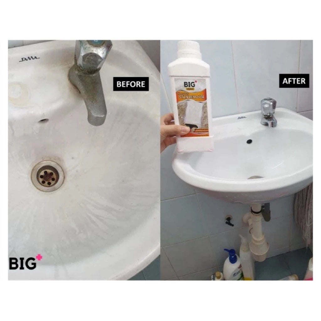 BIG+ Stain Removal Set