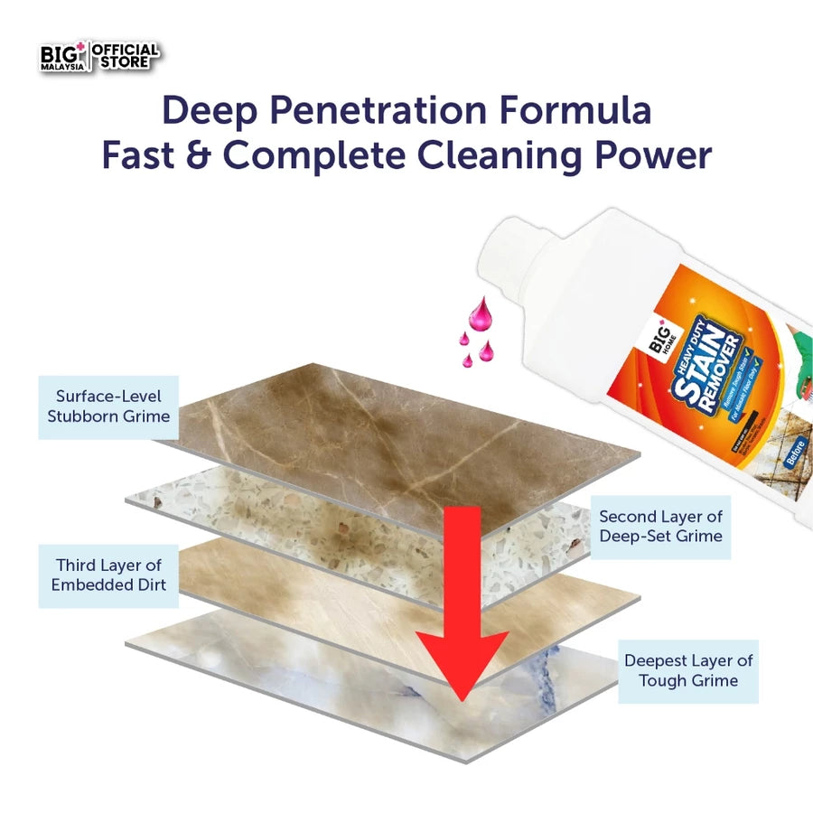 BIG+ Stain Removal Set